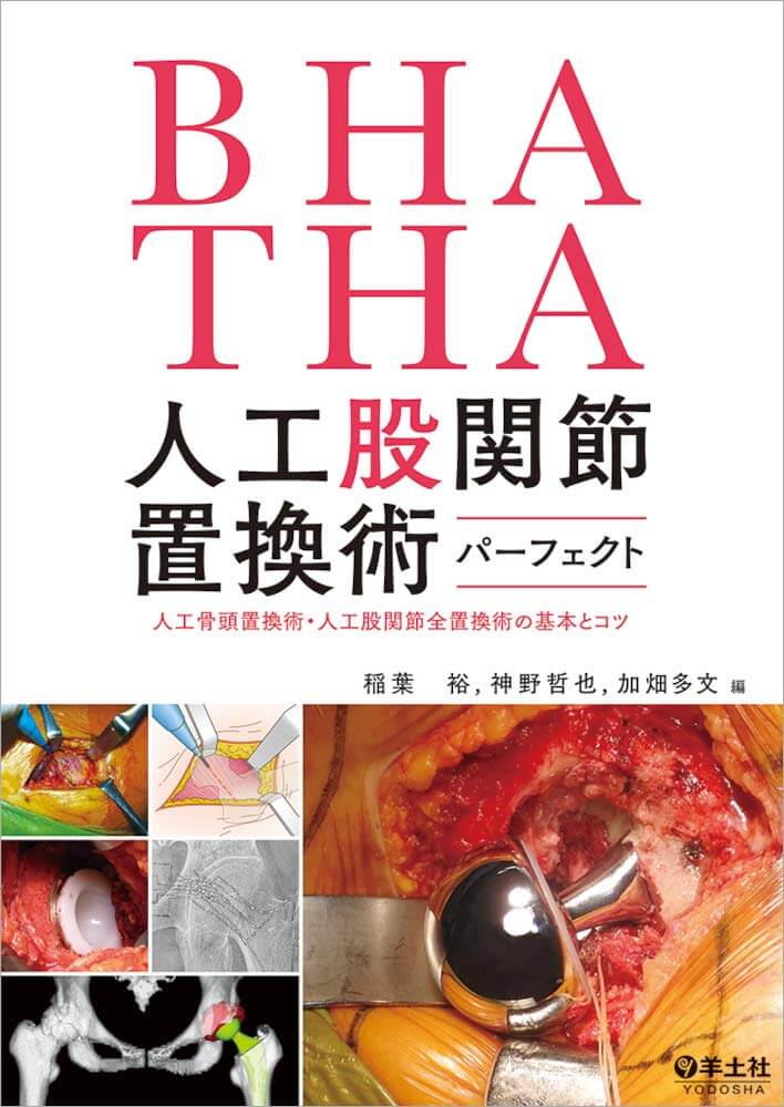 BHA・THA 人工股関節置換術パーフェクト